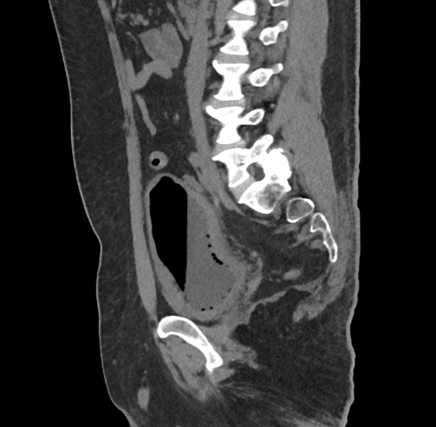 radiology image