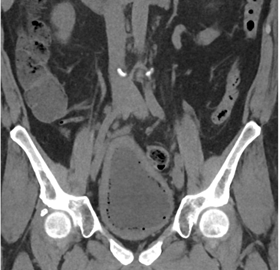 radiology image