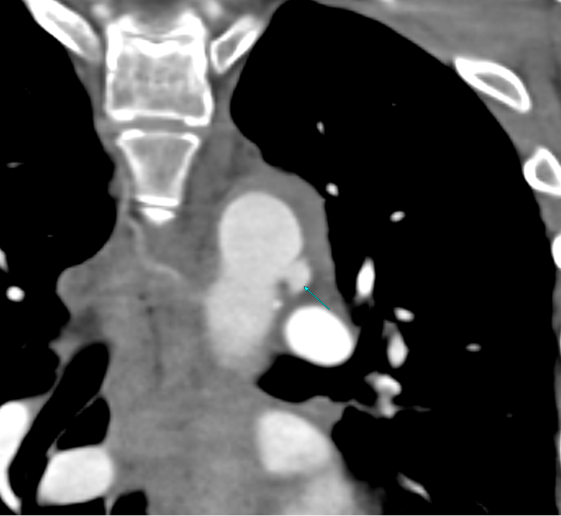 Case of the Month: Department of Radiology: Feinberg School of Medicine